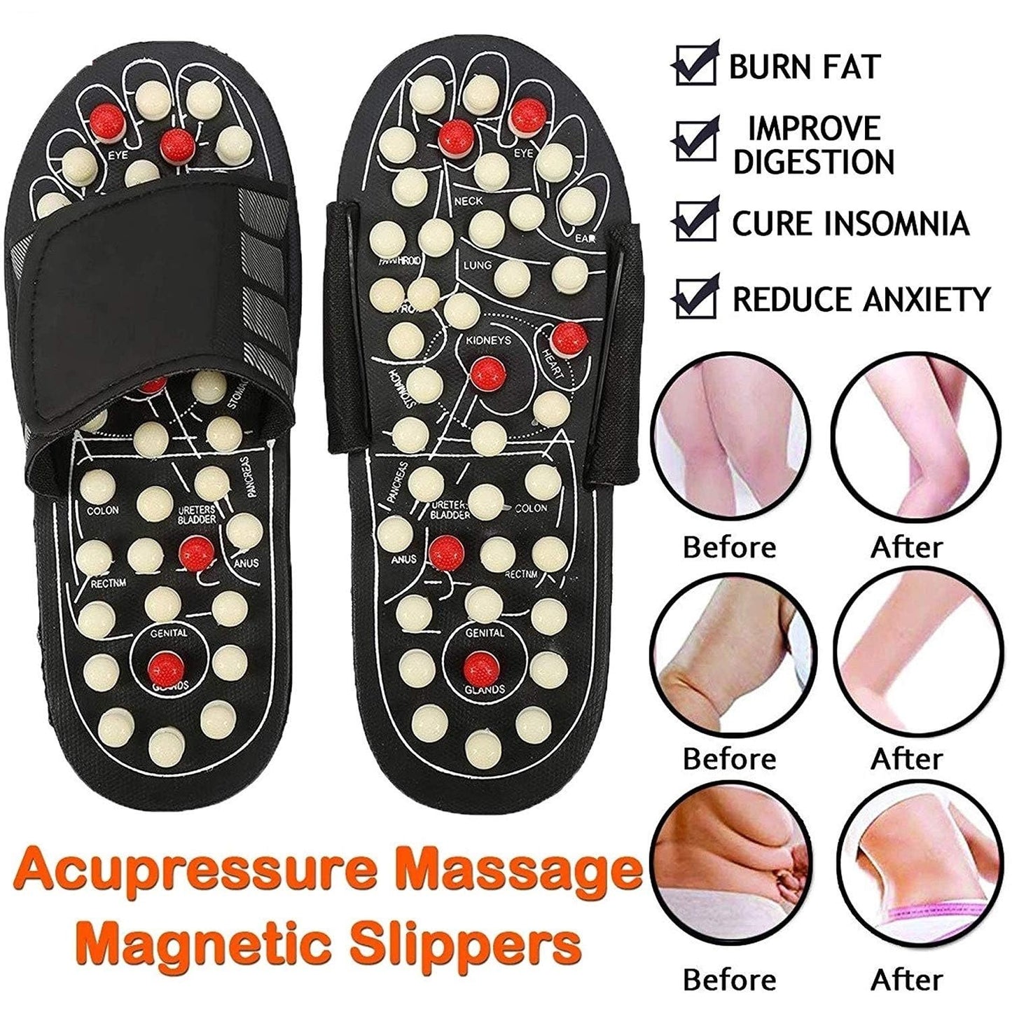 🔥FLAT 50% LEADÁS🔥Acupresszúra és mágneses terápiás papucsok